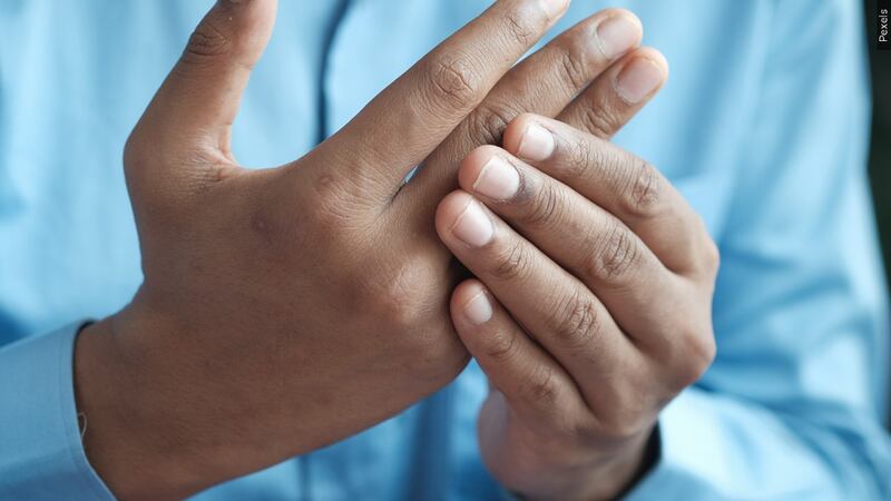 FILE -- Researchers said a man experienced emotional relief after he had two of his fingers...