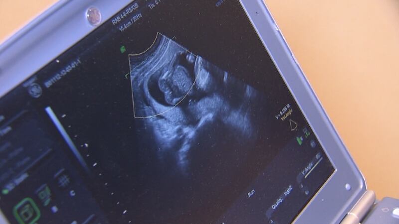 The U.S. Supreme Court has so far been silent on Texas’ ban on abortions after six weeks,...